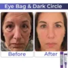LOVILDS Retinol Intense Advanced Triple Action Eye Cream
