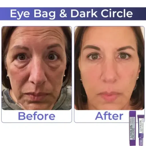 LOVILDS Retinol Intense Advanced Triple Action Eye Cream