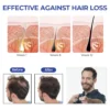 Oveallgo™ ReVita Hair Growth Serum