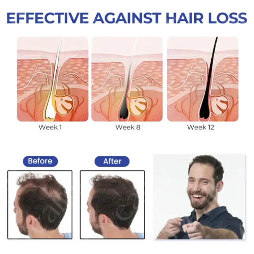 Oveallgo™ ReVita Hair Growth Serum