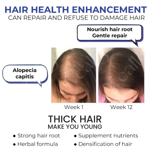 Oveallgo™ ReVita Hair Growth Serum