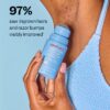 Smoothing Solution Ingrown Hair Treatment reduces irritation and leaves skin smooth after shaving.