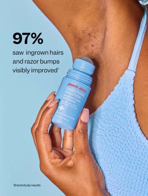 Smoothing Solution Ingrown Hair Treatment reduces irritation and leaves skin smooth after shaving.