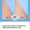 Smoothing Solution Ingrown Hair Treatment hydrates and prevents painful ingrown hairs.