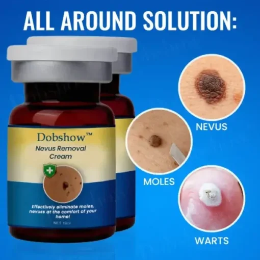 Dobshow™ Nevus Removal Cream