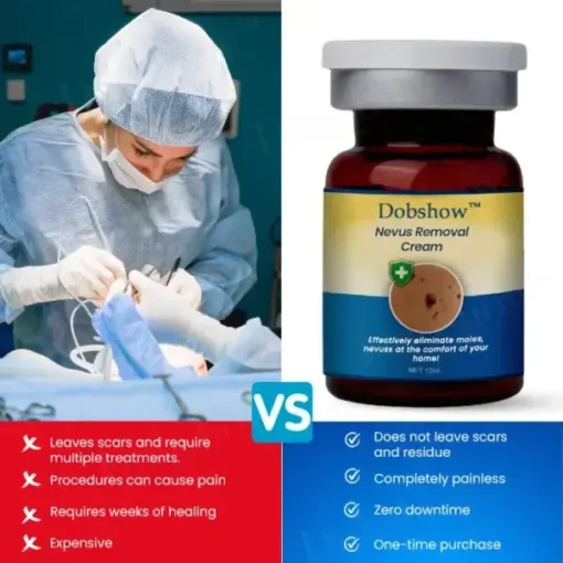 Dobshow™ Nevus Removal Cream